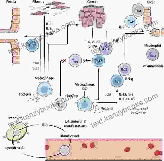 Autoimmune Disease Inflammatory Pathways Anti Inflammatory Diet: Learn How To Eliminate Autoimmune Disease Inflammation(Eliminate Diabetes Prediabetes Insulin Resistance) (Anti Inflammatory Resistence Inflammation Paleo Diabetes)