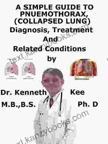 A Simple Guide To Pneumothorax (Collapsed Lungs) Diagnosis Treatment And Related Conditions